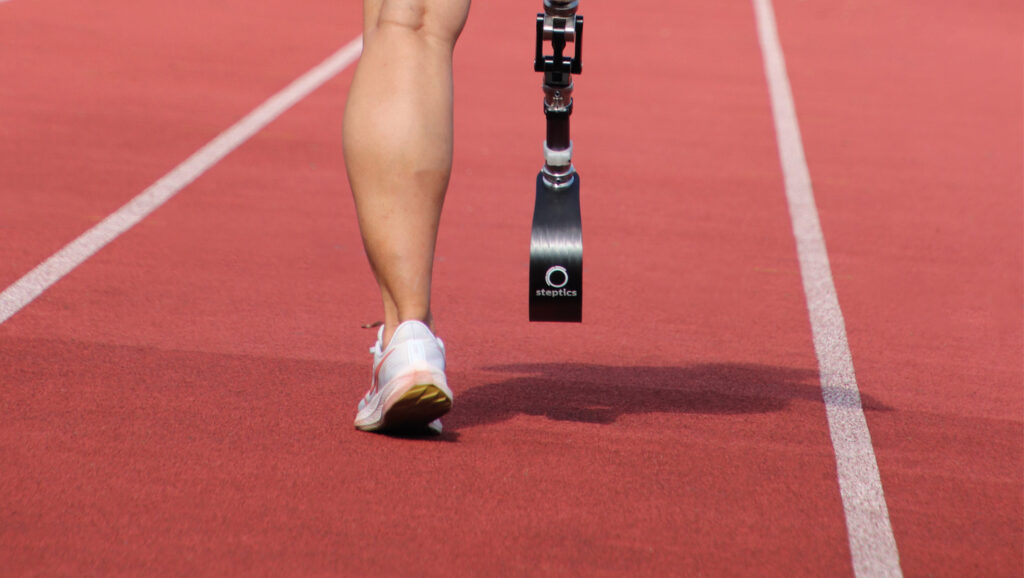 Walking person with a unilateral leg amputation and is wearing a steptics sports prosthesis